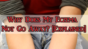 WHY DOES MY ECZEMA NOT GO AWAY?