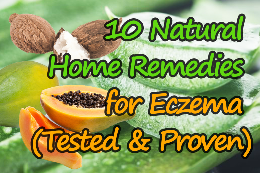 10 Natural Home Remedies For Eczema Tested And Proven Cure Eczema Slowly 